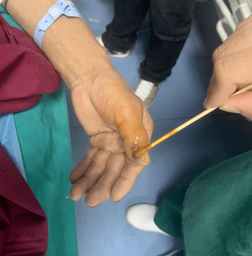 新澳门彩走势和男子在湖边被蛇咬伤与男子在湖边被蛇咬伤视频